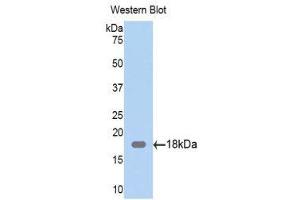 Western Blotting (WB) image for anti-Zyxin (ZYX) (AA 377-523) antibody (ABIN1860974) (ZYX anticorps  (AA 377-523))