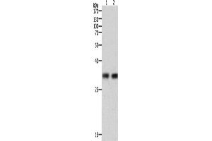 Western Blotting (WB) image for anti-Hepatitis A Virus Cellular Receptor 1 (HAVCR1) antibody (ABIN2431055) (HAVCR1 anticorps)