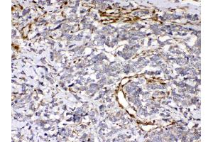 IHC analysis of Cytoglobin using anti- Cytoglobin antibody .