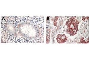 Immunohistochemistry of Rabbit Anti-AKT antibody.