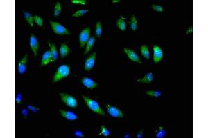 Immunofluorescent analysis of Hela cells using ABIN7163192 at dilution of 1:100 and Alexa Fluor 488-congugated AffiniPure Goat Anti-Rabbit IgG(H+L)