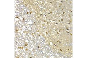 Immunohistochemistry of paraffin-embedded rat brain using S100A4 antibody (ABIN5970801) at dilution of 1/100 (40x lens). (s100a4 anticorps)