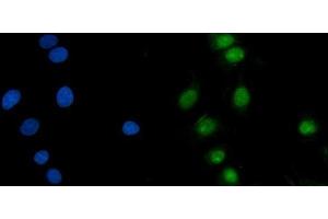 IF analysis of ASF1B using anti-ASF1B antibody (ABIN7599074). (ASF1B anticorps  (AA 1-202))