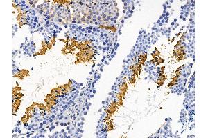 ABIN7094644 and ABIN7098694 at 1/100 staining Mouse testis tissue by IHC-P. (Plastin 3 anticorps  (Internal Region))