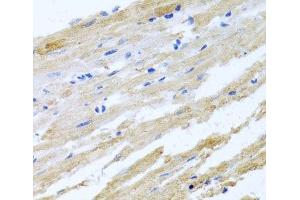 Immunohistochemistry of paraffin-embedded Rat heart using BNIP3 Polyclonal Antibody at dilution of 1:100 (40x lens).