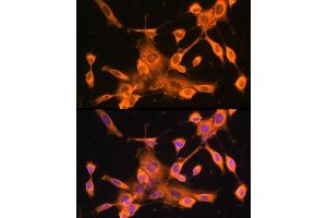 Immunofluorescence analysis of NIH-3T3 cells using FOXO3A Rabbit pAb (ABIN6129381, ABIN6140755, ABIN6140756 and ABIN6213618) at dilution of 100 (40x lens).