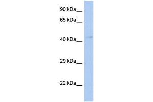 WB Suggested Anti-TFDP3 Antibody Titration:  0. (TFDP3 anticorps  (Middle Region))