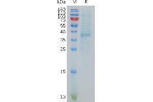 Human C Protein, hFc Tag on SDS-PAGE under reducing condition.