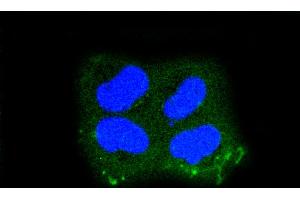 HeLa cells were fixed in paraformaldehyde, permeabilized with 0.