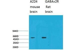 Western Blot (WB) analysis of 1) Mouse Brain Tissue, 2)Rat Brain Tissue with GABA A Receptor alpha2 Rabbit Polyclonal Antibody diluted at 1:2000. (GABRA2 anticorps)