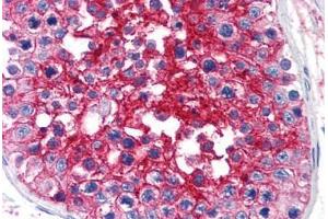 Human Testis (formalin-fixed, paraffin-embedded) stained with BSG antibody ABIN239809 at 10 ug/ml followed by biotinylated anti-mouse IgG secondary antibody ABIN481714, alkaline phosphatase-streptavidin and chromogen. (CD147 anticorps)