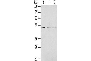 Western Blotting (WB) image for anti-Forkhead Box G1 (FOXG1) antibody (ABIN2431349)
