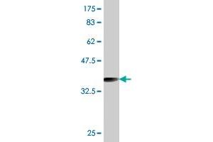 Western Blot detection against Immunogen (36. (RAB27A anticorps  (AA 122-221))
