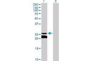 Western Blot analysis of GJB5 expression in transfected 293T cell line by GJB5 MaxPab polyclonal antibody. (GJB5 anticorps  (AA 1-273))