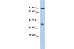 WB Suggested Anti-C6orf154 Antibody Titration: 0. (C6orf154 anticorps  (Middle Region))