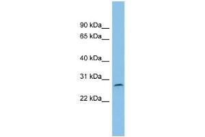 C1orf104 antibody used at 1 ug/ml to detect target protein. (C1orf104 anticorps  (Middle Region))