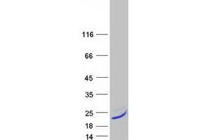 Validation with Western Blot