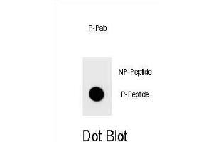 Dot blot analysis of Phospho-TOPBP1- Antibody Phospho-specific Pab (ABIN1539690 and ABIN2839840) on nitrocellulose membrane. (TOPBP1 anticorps  (pSer1159))
