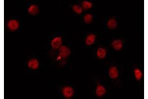 ABIN6266721 staining Hela by IF/ICC. (Musculin anticorps  (Internal Region))