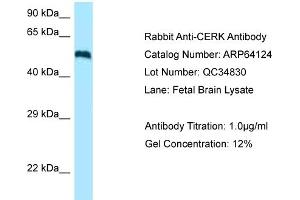Western Blotting (WB) image for anti-Ceramide Kinase (CERK) (C-Term) antibody (ABIN970379) (CERK anticorps  (C-Term))