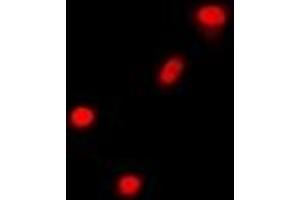 Immunofluorescent analysis of Cbl-3 staining in A549 cells. (CBLC anticorps)
