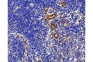 Immunohistochemistry analysis of paraffin-embedded mouse thymus using LDLR Polyclonal Antibody at dilution of 1:300. (LDLR anticorps)