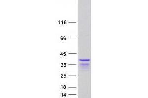 Validation with Western Blot
