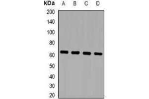 Western blot analysis of ZNF307 expression in MCF7 (A), HepG2 (B), mouse brain (C), mouse lung (D) whole cell lysates. (ZKSCAN4 anticorps)