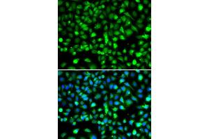 Immunofluorescence analysis of MCF-7 cells using SMYD1 antibody (ABIN6128707, ABIN6148163, ABIN6148165 and ABIN6219496). (SMYD1 anticorps  (AA 1-350))