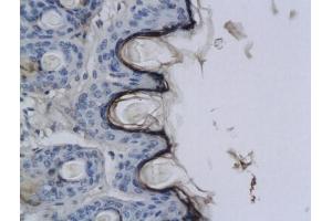 Formalin-fixed and paraffin embedded rat skin labeled with Anti-CNR2/CB2 Polyclonal Antibody, Unconjugated (ABIN680168) at 1:200 followed by conjugation to the secondary antibody and DAB staining. (CNR2 anticorps  (AA 251-350))