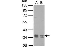 WB Image Sample (30 ug of whole cell lysate) A: HeLa B: HepG2 10% SDS PAGE antibody diluted at 1:1000