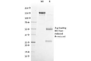 SDS-PAGE Analysis Purified NKX6.