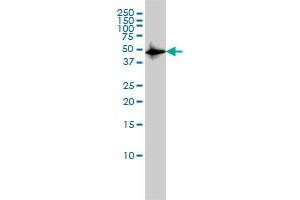 CSK monoclonal antibody (M01), clone 3A3 Western Blot analysis of CSK expression in HL-60 . (CSK anticorps  (AA 1-100))