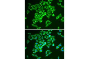 Immunofluorescence analysis of A549 cell using KEAP1 antibody.
