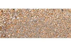 Immunohistochemistry of paraffin-embedded Human tonsil tissue using GNGT2 Polyclonal Antibody at dilution of 1:40(x200)