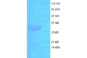 SDS-PAGE (SDS) image for Microfibrillar Associated Protein 5 (MFAP5) (AA 22-173) protein (His-SUMO Tag) (ABIN5711325)