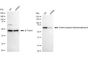 Western blotting analysis using protein arginine methyltransferase 5 antibody (ABIN7799971). (Recombinant PRMT5 anticorps)
