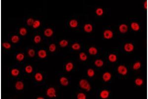 ABIN6266630 staining HepG2 by IF/ICC.