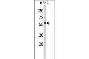 Western blot analysis of hMMP19-R359 in K562 cell line lysates (35ug/lane) (MMP19 anticorps  (C-Term))