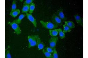 Detection of NT5C3 in Human Hela Cell using Polyclonal Antibody to 5'-Nucleotidase, Cytosolic III (NT5C3)