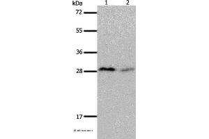 Western blot analysis of Mouse brain and kidney tissue, using KLK7 Polyclonal Antibody at dilution of 1:600 (Kallikrein 7 anticorps)