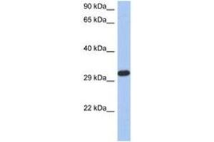 Image no. 1 for anti-Capping Protein (Actin Filament) Muscle Z-Line, alpha 3 (CAPZA3) (N-Term) antibody (ABIN6744292) (CAPZA3 anticorps  (N-Term))