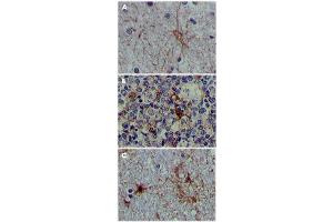 Immunohistochemical analysis of paraffin-embedded human brain tissue (A), lymphoid follicles tissue (B) and interbrain tissue (C), showing cytoplasmic localization. (S100A1 anticorps)