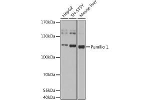 Western blot analysis of extracts of various cell lines, using Pumilio 1 antibody (ABIN6132539, ABIN6146494, ABIN6146496 and ABIN6217367) at 1:1000 dilution. (PUM1 anticorps  (AA 1-130))