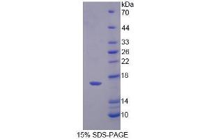 Image no. 1 for Profilin 4 (PFN4) (AA 1-125) protein (His tag) (ABIN6239660)