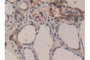 Detection of CASP3 in Human Thyroid Tissue using Polyclonal Antibody to Caspase 3 (CASP3)