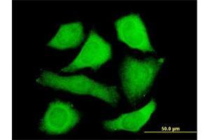 Immunofluorescence of purified MaxPab antibody to STIP1 on HeLa cell.