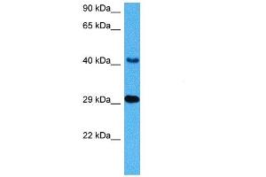 Host:  Mouse  Target Name:  CTSD  Sample Tissue:  Mouse Heart  Antibody Dilution:  1ug/ml (Cathepsin D anticorps  (C-Term))