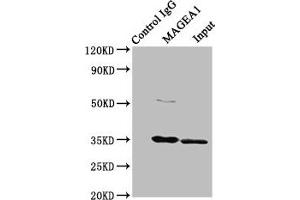 Immunoprecipitating MAGEA1 in Hela whole cell lysate Lane 1: Rabbit control IgG instead of ABIN7159251 in Hela whole cell lysate. (MAGEA1 anticorps  (AA 1-309))