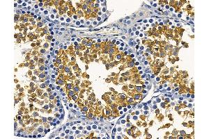 ABIN7096941 and ABIN7101007 at 1/100 staining mouse testis tissue by IHC-P. (KLHDC8A anticorps)